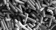 Lactobacillus johnsonii, SEM image by Kathryn Cross, IFR